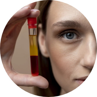 Prp / Vampirlifting