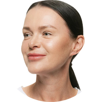 Sculptra